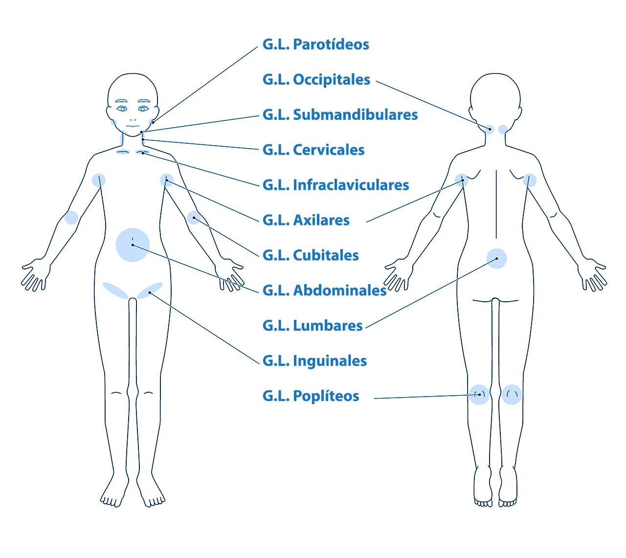 Dibujo del cuerpo humano, donde se señalan los grupos ganglionares y donde suele haber ganglios linfáticos inflamados.