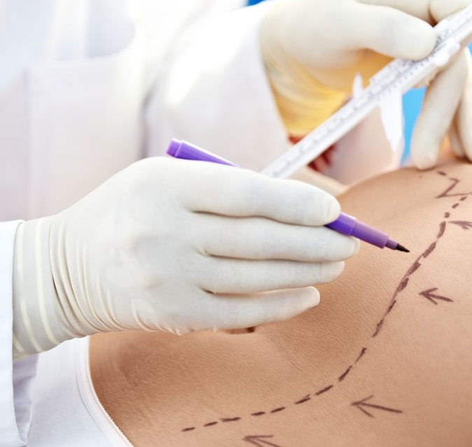 cirugia-plastica-y-reconstructiva