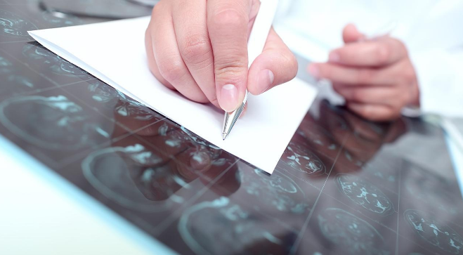 Epilepsia | Tratamiento para la Epilepsia