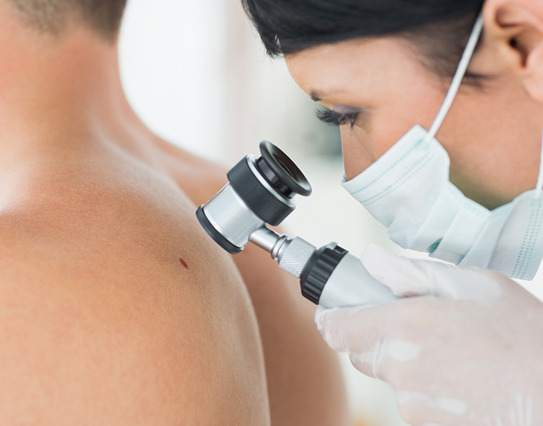 Prevención y Tratamiento en Cáncer de Piel