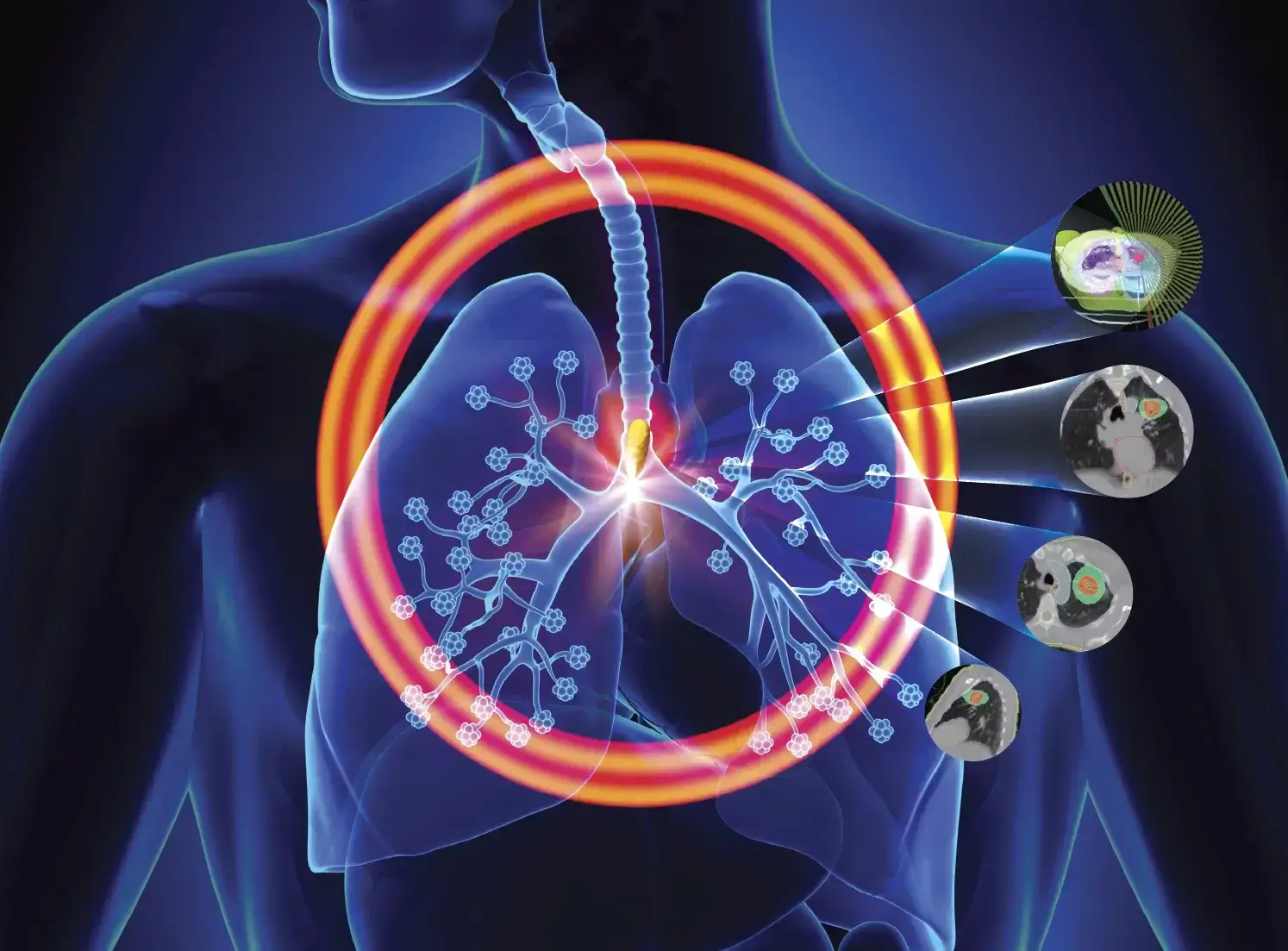 III Curso Internacional de Cáncer de Pulmón 2022