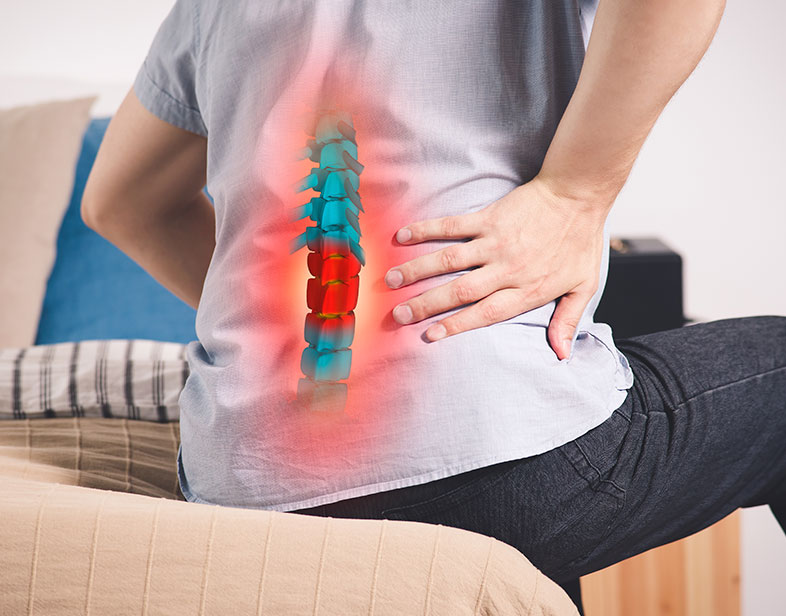 Tengo una hernia de disco, ¿es necesario operarme?