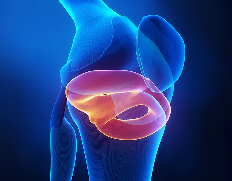 Lesiones meniscales en rodillas