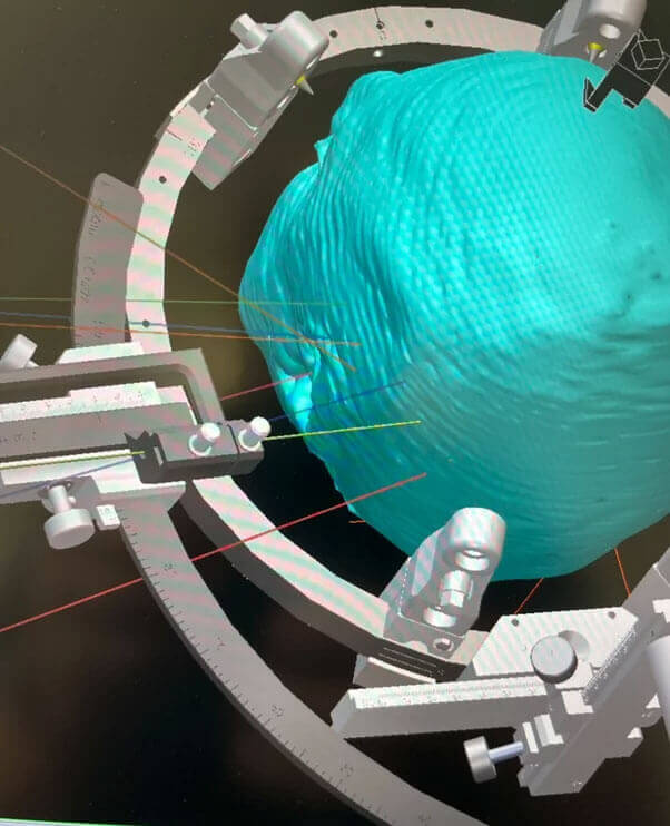 Reconstrucción 3D