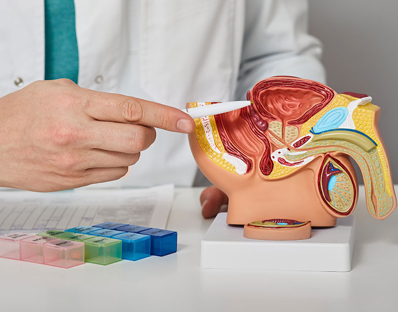 El cáncer de próstata es curable si se detecta a tiempo