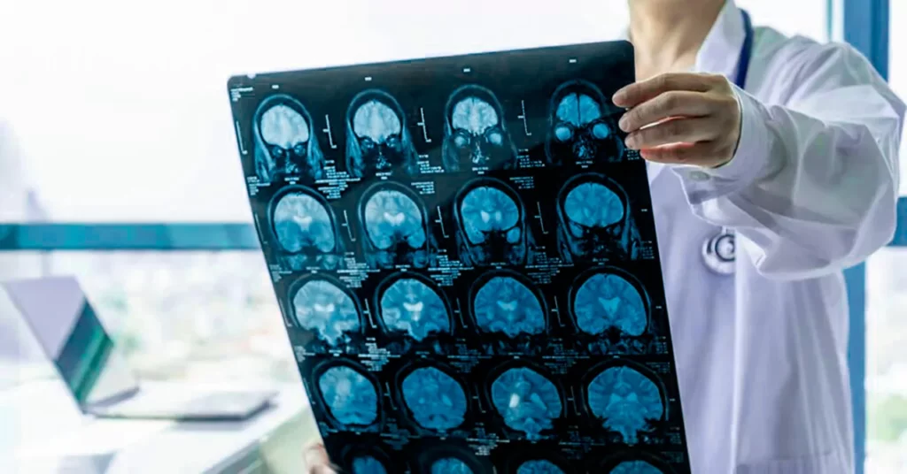 Médico sosteniendo un estudio para identificar si hay problemas neurológicos que ponen en riesgo la salud de su paciente.
