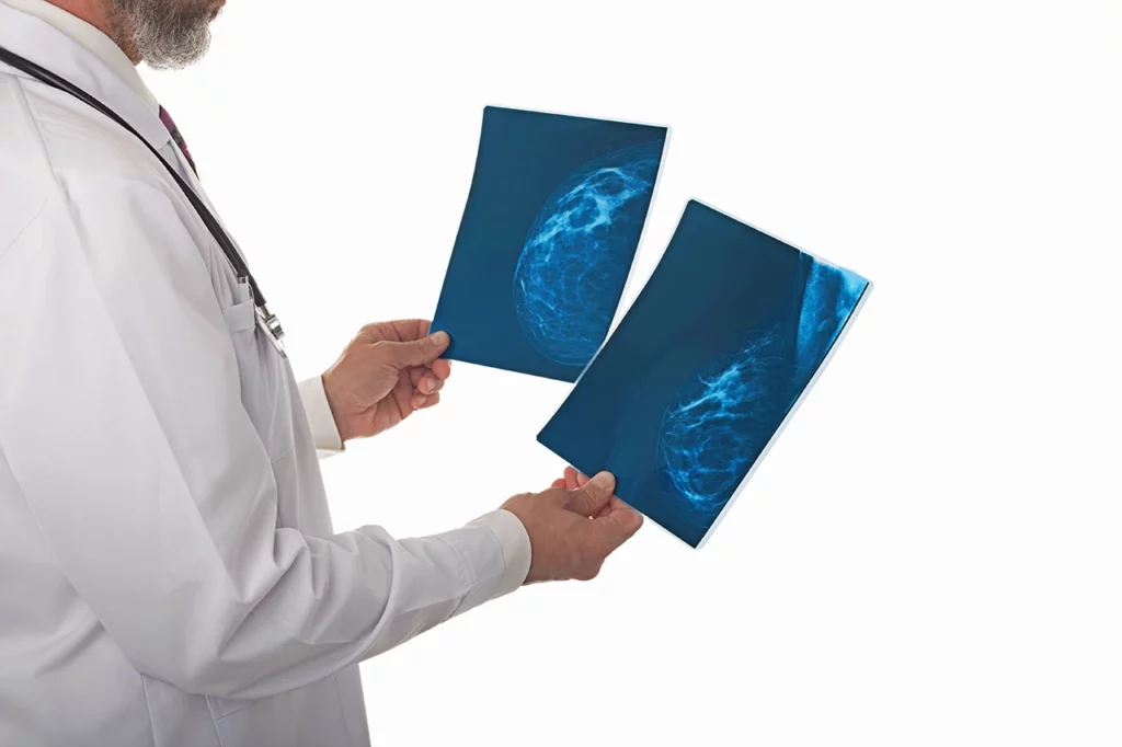 Especialista revisando unas radiografías que son uno de los múltiples estudios de imagen radiológica de la mama.
