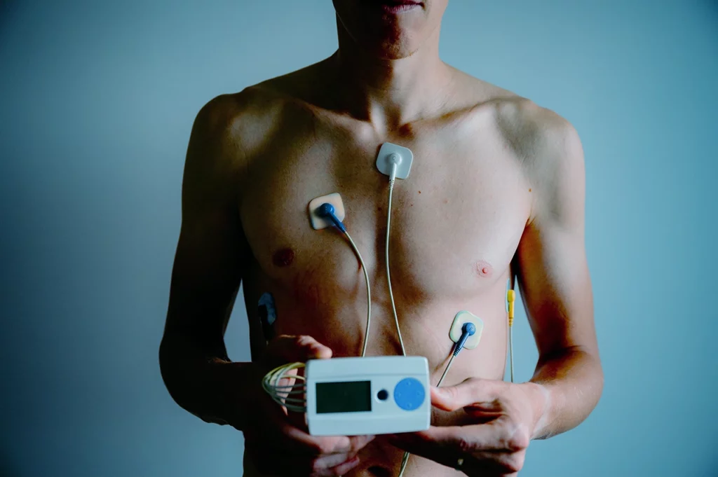 Hombre con un equipo Holter para buscar el diagnóstico de un posible síncope cardíaco que ha estado presentando.