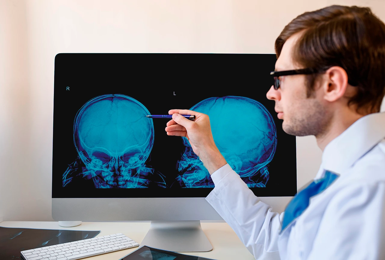 Trauma craneoencefálico: mitos y avances científicos