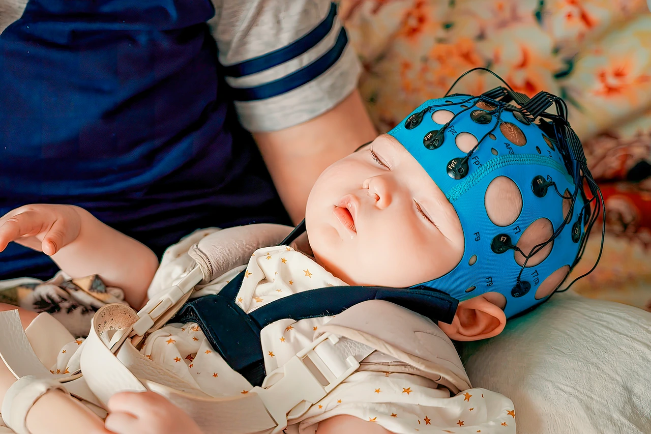 Crisis convulsivas en pacientes pediátricos