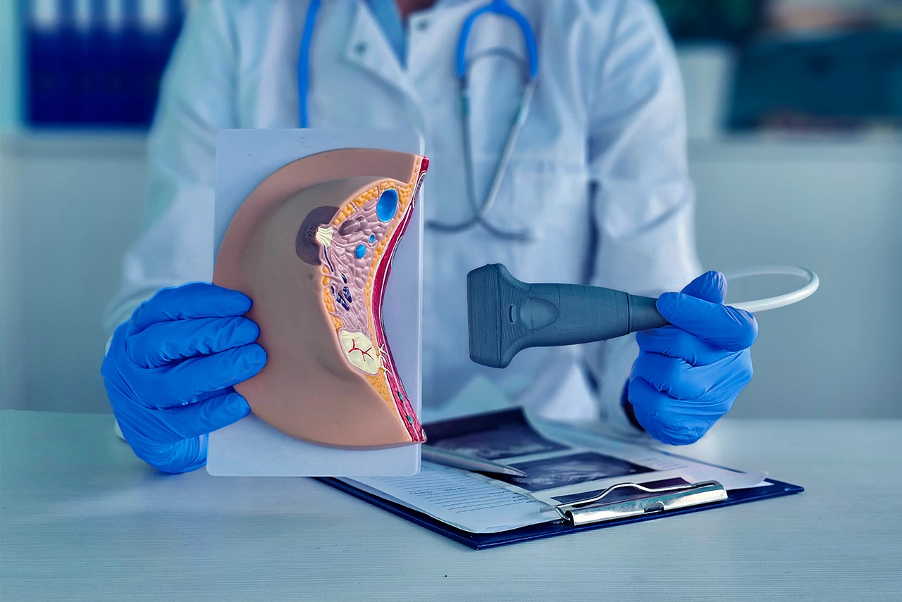 Cáncer de mama: detección temprana y opciones de tratamiento