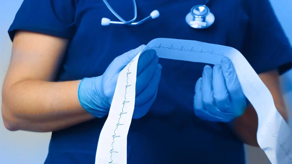 Médico revisando un electrocardiograma para identificar en la fibrilación ventricular, causas posibles para su desarrollo.