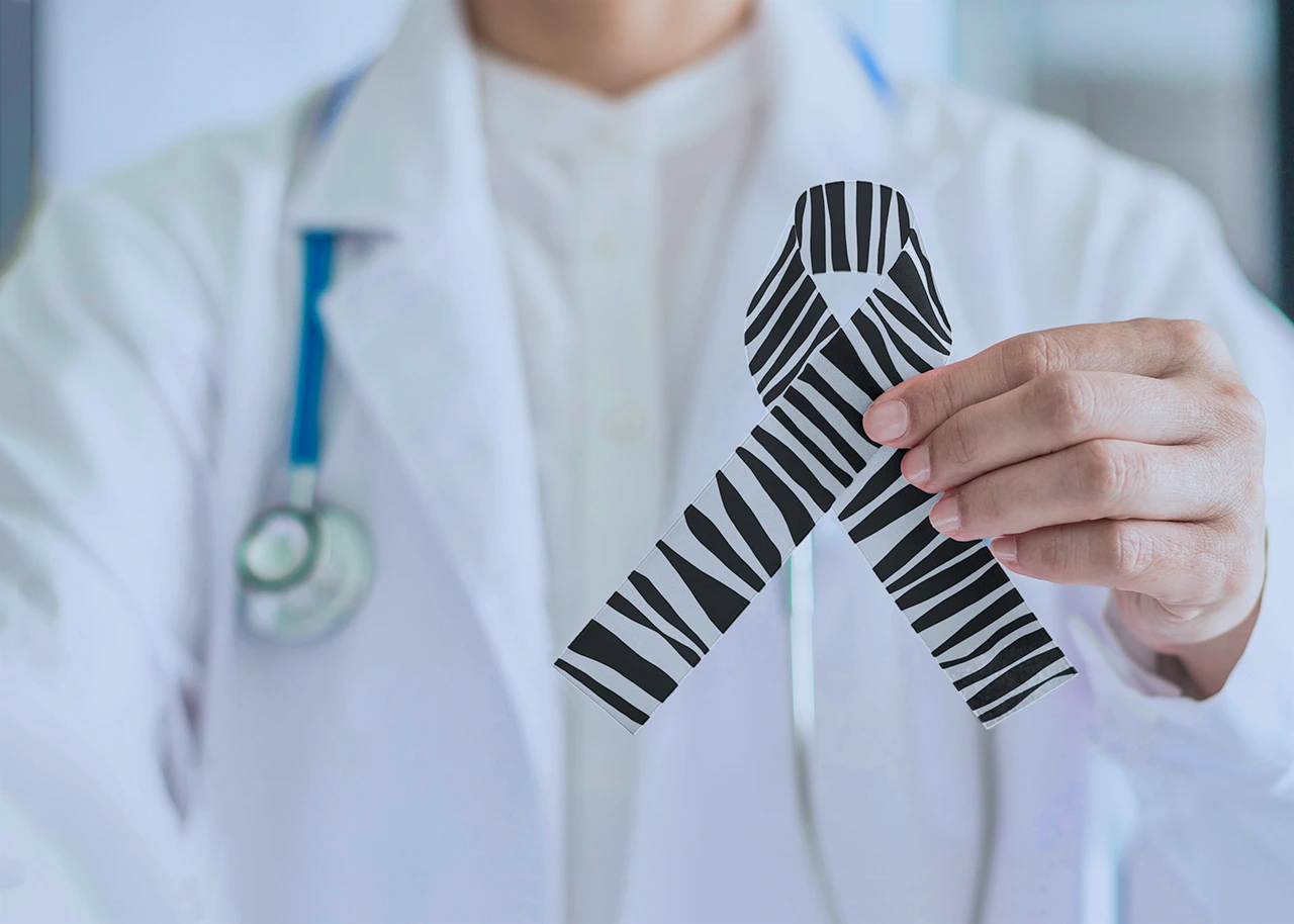 Síndrome de Ehlers Danlos Hipermóvil y Trastorno del Espectro Hipermóvil