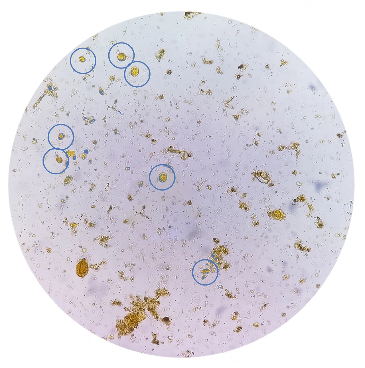 El Blastocystis hominis aparece en un examen microscópico de heces.