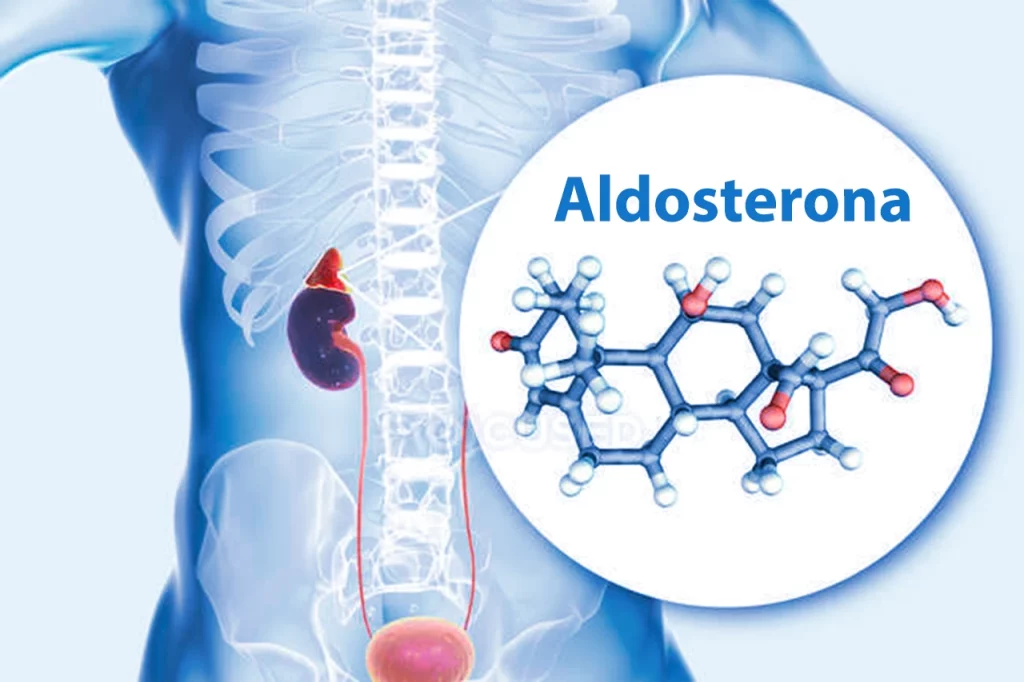 Dibujo de un cuerpo donde se ven los riñones y una molécula de aldosterona para representar el hiperaldosteronismo.