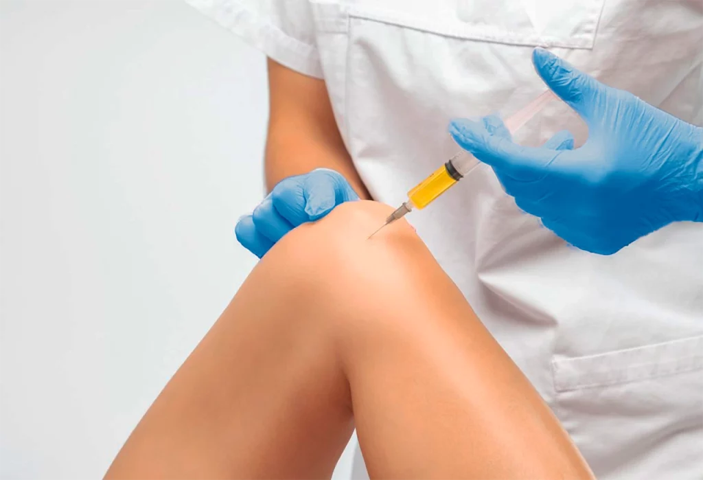 Médico inyectando plasma rico en plaquetas en la rodilla de un paciente para atender la artrosis que presenta.